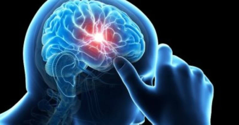 أطباء يحددون مجموعة من العلامات الحيوية لاكتشاف ارتجاج الدماغ بشكل مبكر
