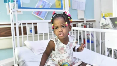 استقرار حالة التوأم الجامايكي وآثار العلاج على حياة "أزاريا" و"أزورا"