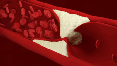 علامات تحذيرية وأسباب تدل على ارتفاع الكوليسترول في الجسم