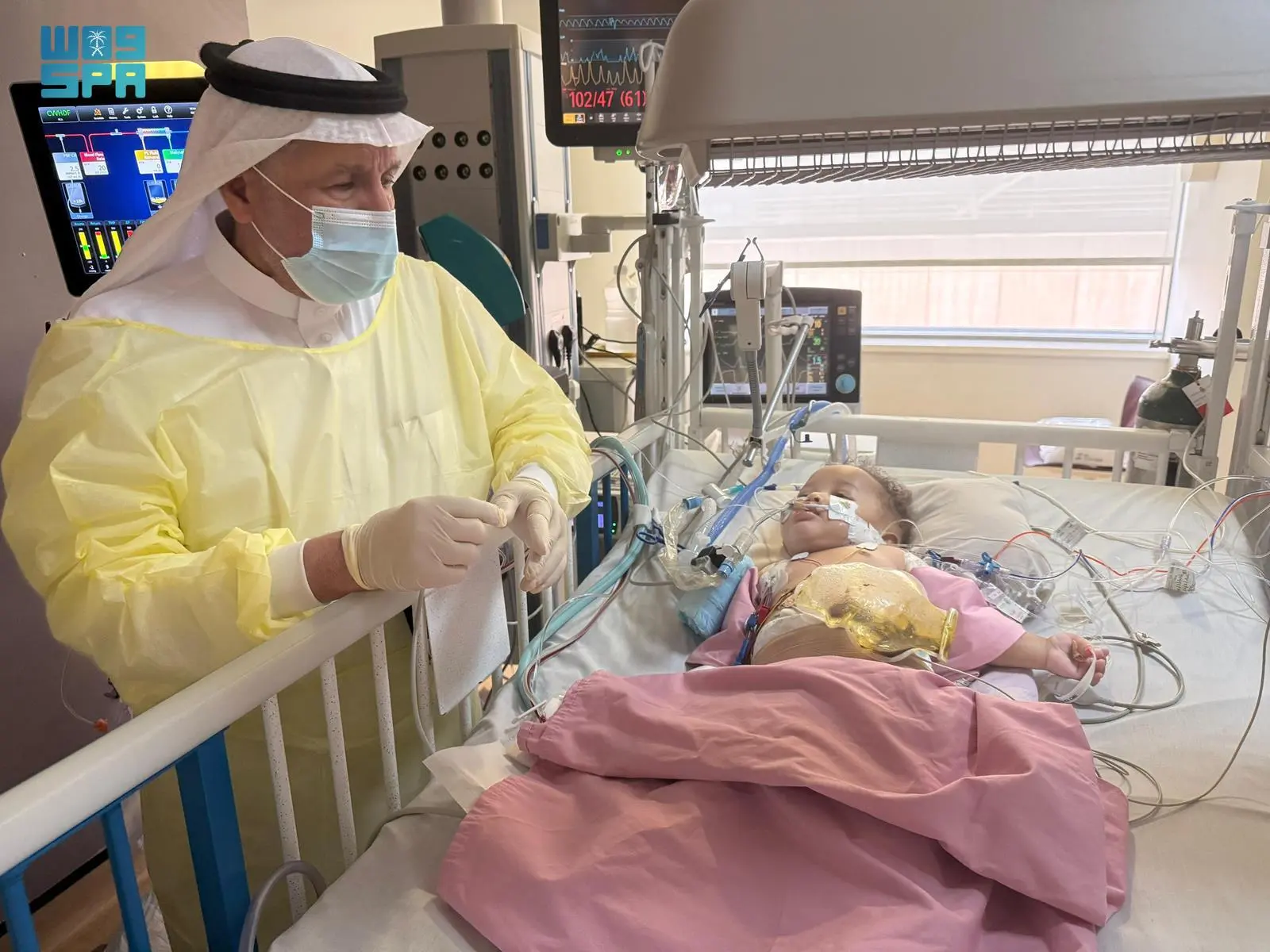 التوأم الصومالي رحمة ورملا: استقرار حالتهما الصحية بعد 4 أيام من نجاح عملية فصلهما